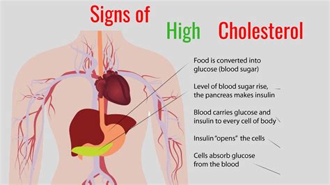 7 Common Signs of High Cholesterol - YouTube