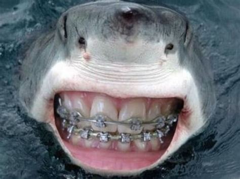 22 Sharks With Human Teeth Pictures That Are Just Ridiculous