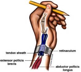 De Quervain's Syndrome | Pinnacle Orthopaedics