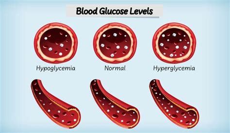 Tresiba vs Levemir: Choosing the Right Path for Diabetes Control