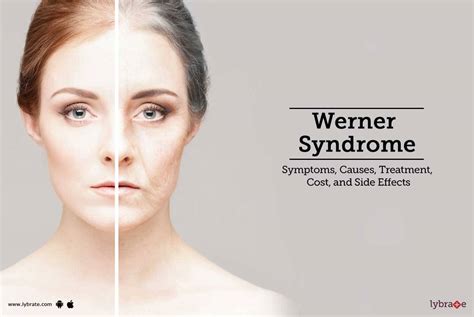 Werner Syndrome: Symptoms, Causes, Treatment, Cost, and Side Effects