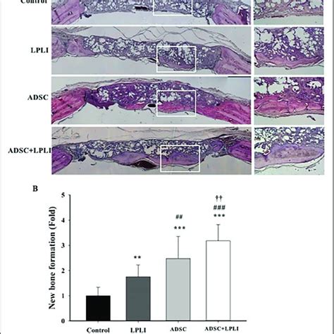 Histomorphological analysis of the calvarial defects at 16 weeks ...