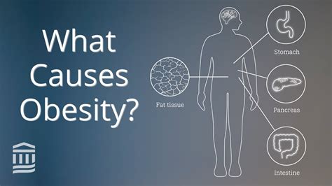 Obesity: Causes, Health Conditions, and Treatment | Mass General Brigham - YouTube