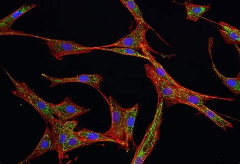 Types of Mesenchymal Stem Cells (MSCs)