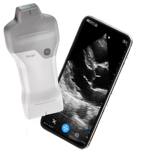 Vscan Air™ SL - Wireless Handheld Ultrasound - GE HealthCare