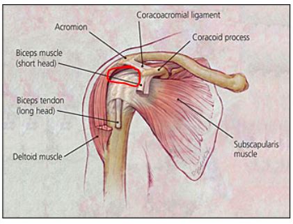 Feeling the pain of shoulder impingement syndrome