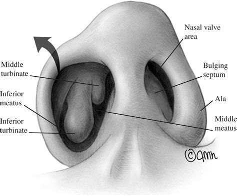 Surgical Anatomy of the Paranasal Sinus | Ento Key