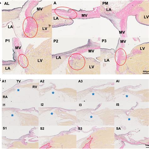 Histology of the mitral and tricuspid valve annuli. (A) Six sections ...