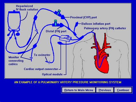 hemodynamic monitoring | Hemodynamic Monitoring Part I: Waveform ...