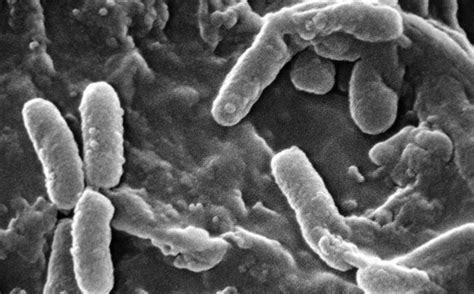 Pseudomonas aeruginosa meets the plant root - The Microbial Menagerie