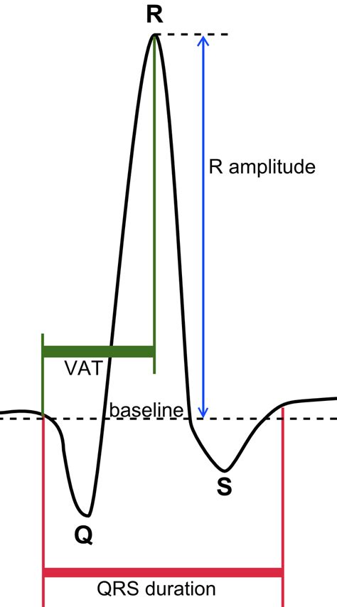 How to Interpret an ECG in Seven Steps | Online Medical Library