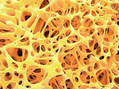 diagram of spongy bone