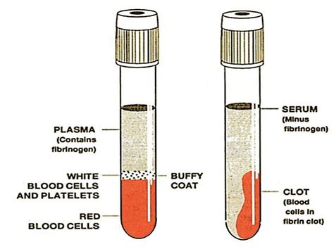 difference between Plasma and Serum | Medical Laboratories