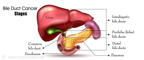 Pictures Of Bile Duct