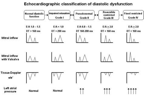 Diastolic dysfunction | Learn the Heart