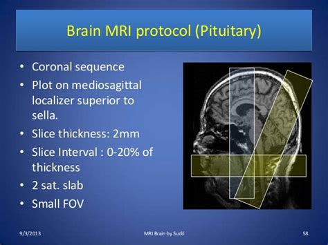 MRI Procedure of Brain