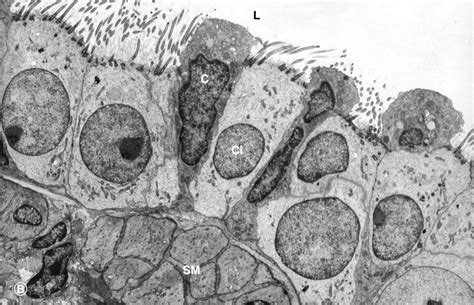 Electron Micrograph