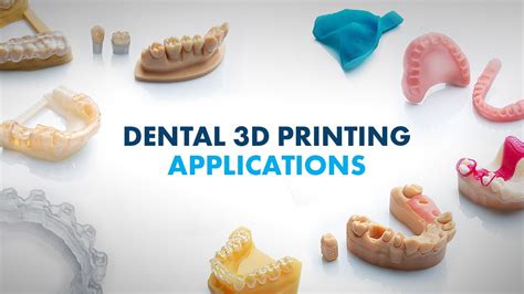 Revolutionizing Dental Care: The Magic of 3D Printing