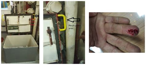 Finger injury: pinch point – IMCA