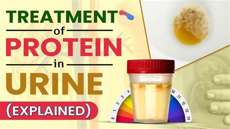 Treatment Of Protein In Urine (Explained) - YouTube