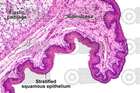 Man. Epiglottis. Longitudinal section. 125X - Man - Mammals - Respiratory system - Other systems ...