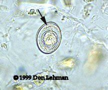 Diagnostic Parasitology; H-nana