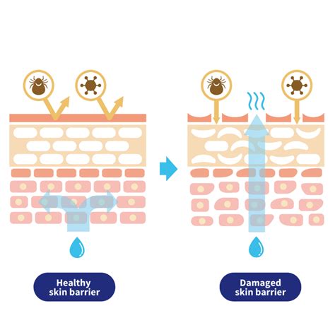 Picky Guide: All About Skin Barrier - Picky | The K-Beauty Hot Place