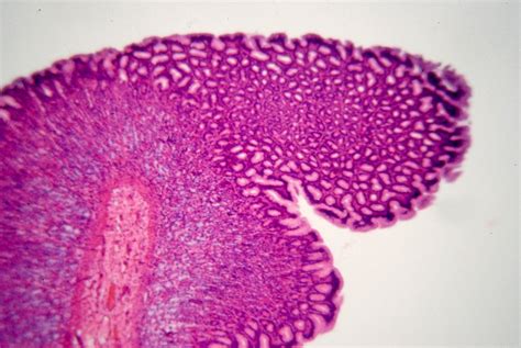 Human's stomach - microscopic view 1 Free Photo Download | FreeImages