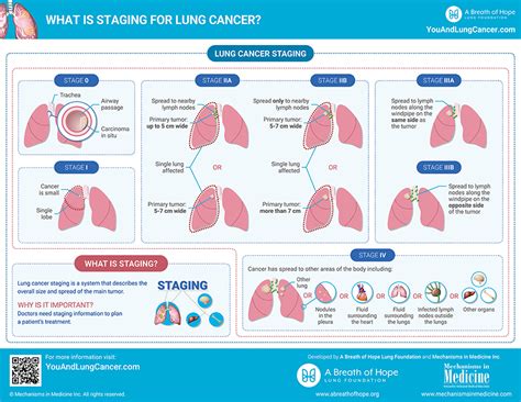 Infographics