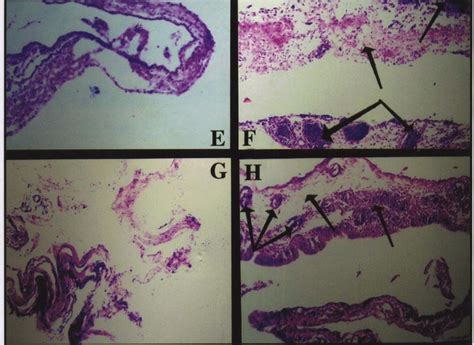 E) Air-sacs of birds in uninfected-untreated group showing normal... | Download Scientific Diagram