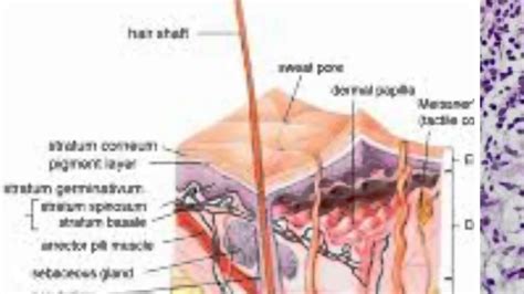 Hidradenitis Suppurativa Surgery - YouTube