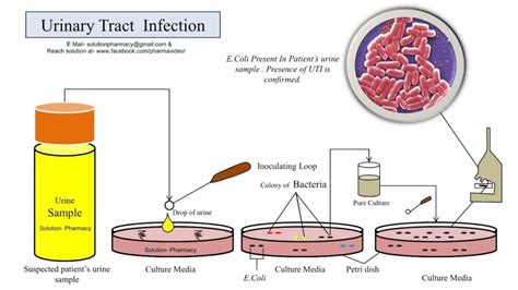 Urine Culture test Price, Purpose, Timing & Report [2024] • Bookmerilab