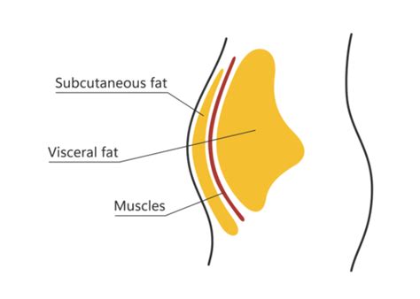 Visceral And Subcutaneous Fat Around Waistline, Insulin, Fat, Diagram ...