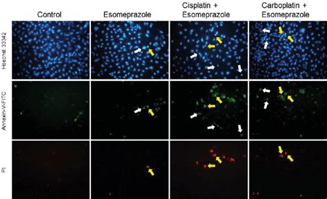 Fluorescence images of cells were taken after staining with Hoechst dye... | Download Scientific ...