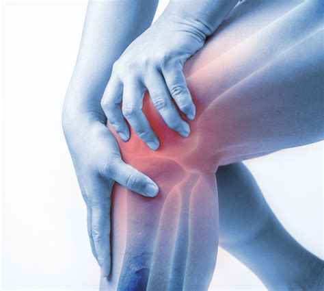 Bursitis: Knee Pain Could Be Rooted in Inflammation of Knee Bursae ...