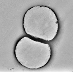 Picrophilus - microbewiki