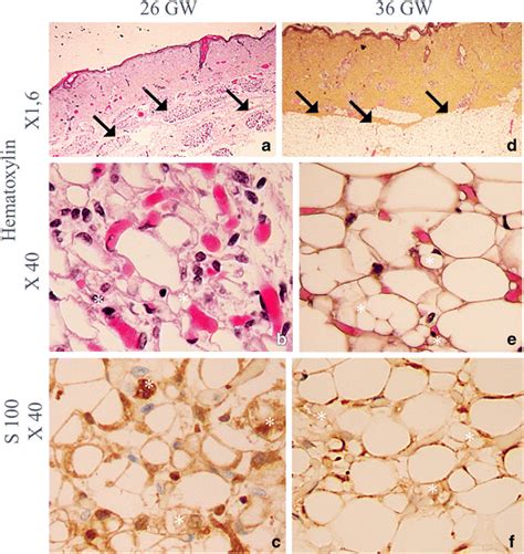 Histological patterns of fetal subcutaneous tissue. a–c At 26 weeks of... | Download Scientific ...