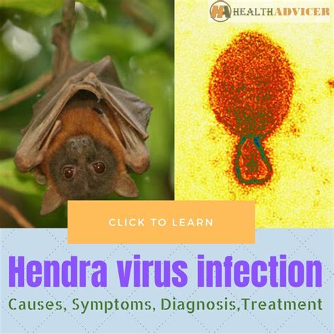 Hendra Virus Infection - Causes, Symptoms, Diagnosis, Treatment