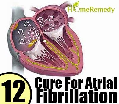 Natural Cure For Atrial Fibrillation ~ Mzizi Mkavu