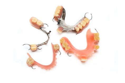 Metal or acrylic partial dentures – which one is best for you ...