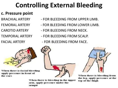 Controlling External Bleeding