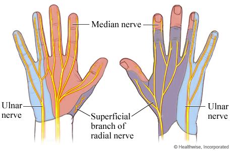 median nerve in hand image - Google Search | Median nerve, Ulnar nerve, Hand therapy