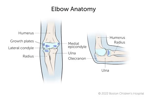 Broken Elbows in Children | Boston Children's Hospital