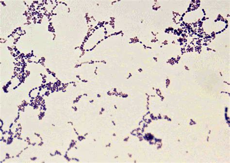 Streptococcus Salivarius Gram Stain