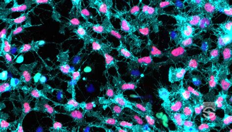 STEMdiff™ Neural Crest Differentiation Kit | STEMCELL Technologies