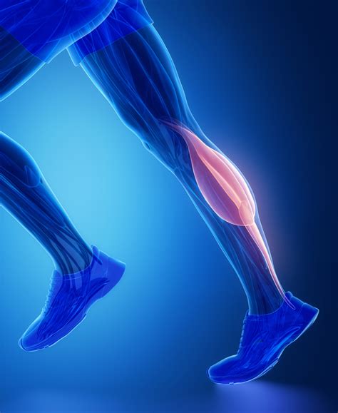 Tennis Leg, Strained Calf Muscle Treatment | Charschan Chiropractic