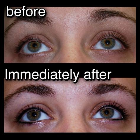 top eyeliner tattoo before and after - a bugs life