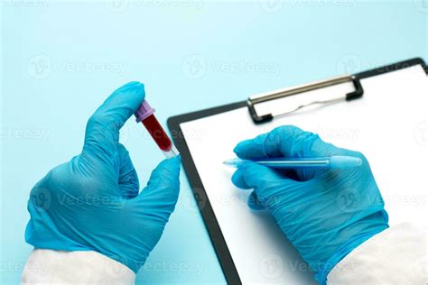 Blood Analysis Stock Photos, Images and Backgrounds for Free Download