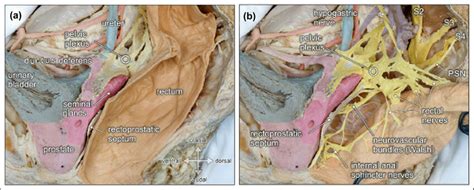 Topographic anatomy of the posterior pelvic compartment. Medial view of... | Download Scientific ...