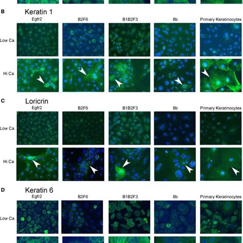 Immortalized cells express keratinocyte markers and differentiate in ...